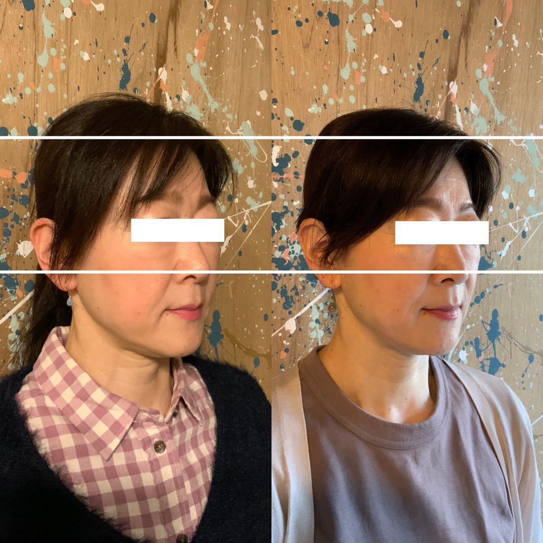 ビフォーアフター