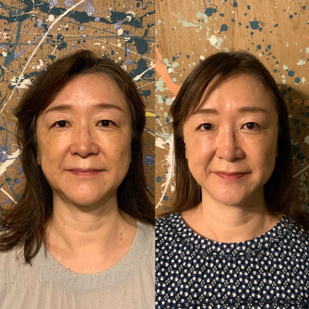 ビフォーアフター