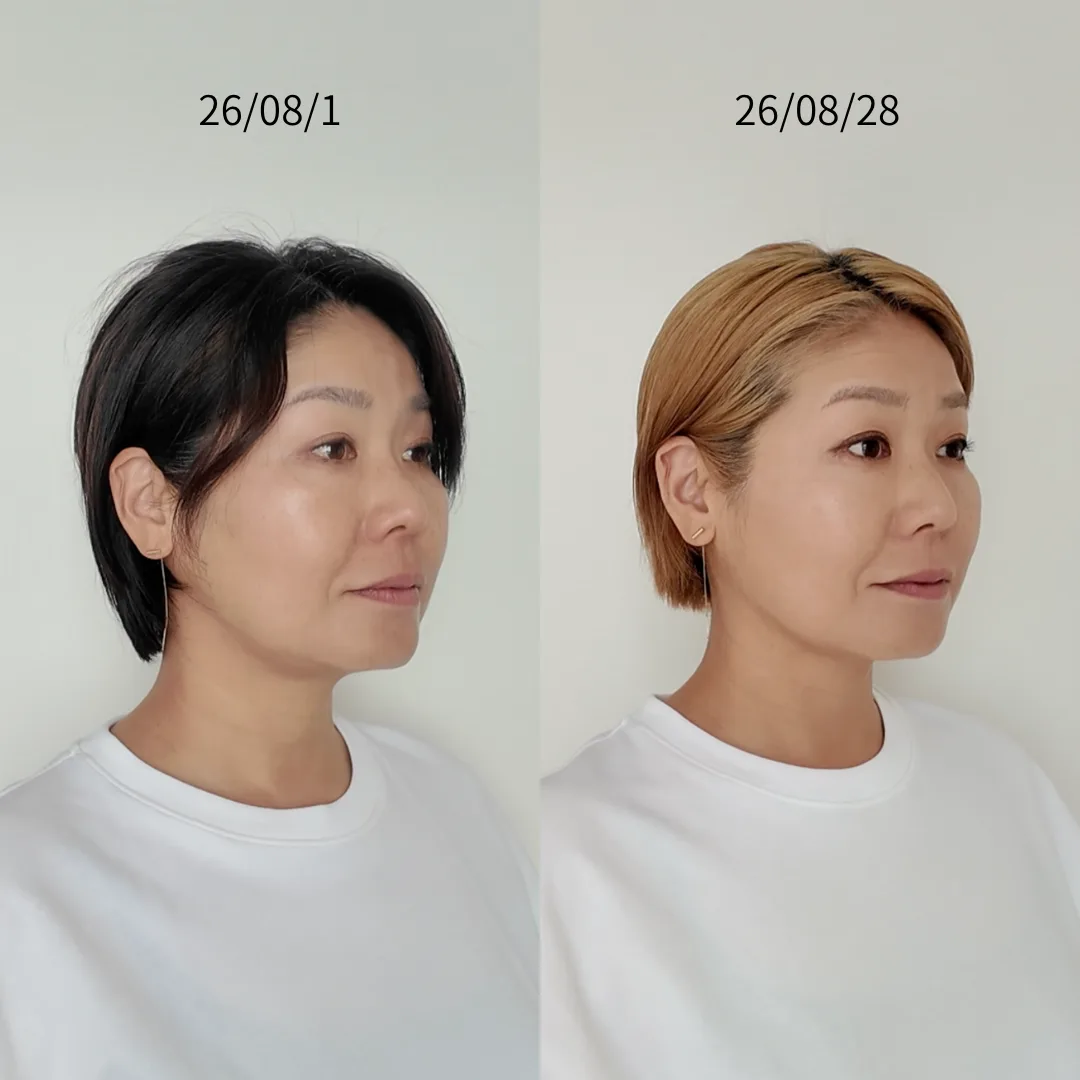 1か月のビフォーアフター・斜め45度