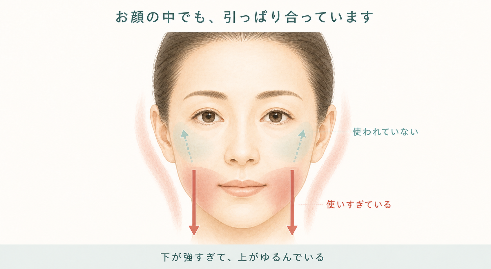 お顔の中でも引っぱり合っています。口のまわりは使いすぎて下に引っぱり、頬は使われていない