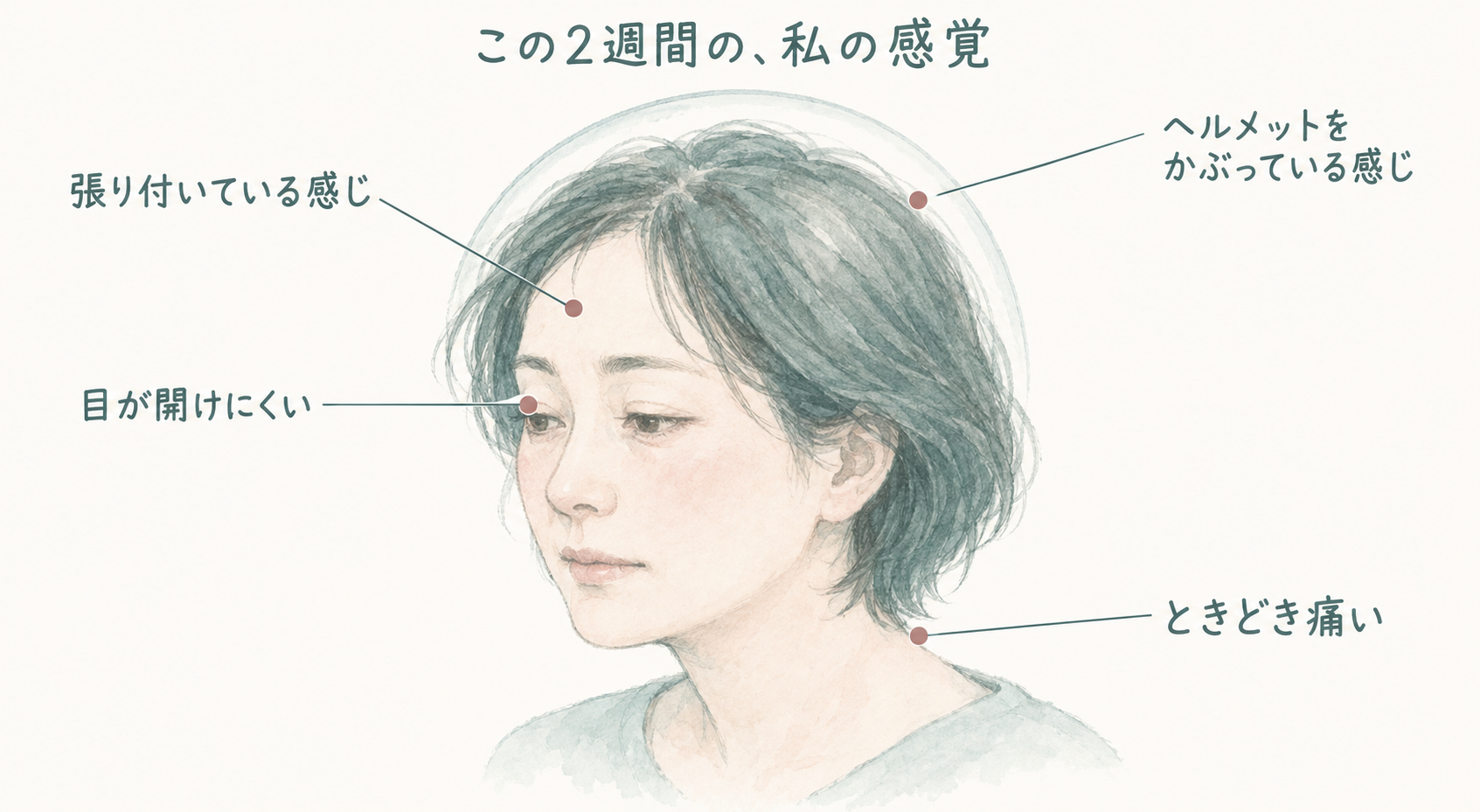 この2週間の、私の感覚。目が開けにくい／ヘルメットをかぶっている感じ／ときどき痛い／張り付いている感じ